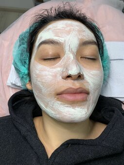 Омоложение лица в студии косметологии «LaEsthetics» в Киеве. Записаться на процедуры со скидкой.