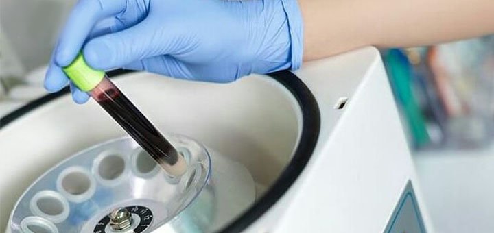 Професійні стоматологи дантисти у стоматології Vorobiova Dental Clinic у Дніпрі. Лікуйте зуби за акцією.