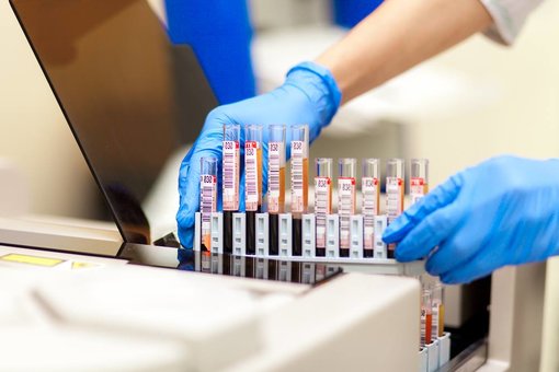 Лаборатория «Invitro». Скидки на анализы